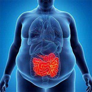 Obezite Medikal Tedavisi Nasıl Yapılır? İlaçlar, Takip ve Beslenme Önerileri