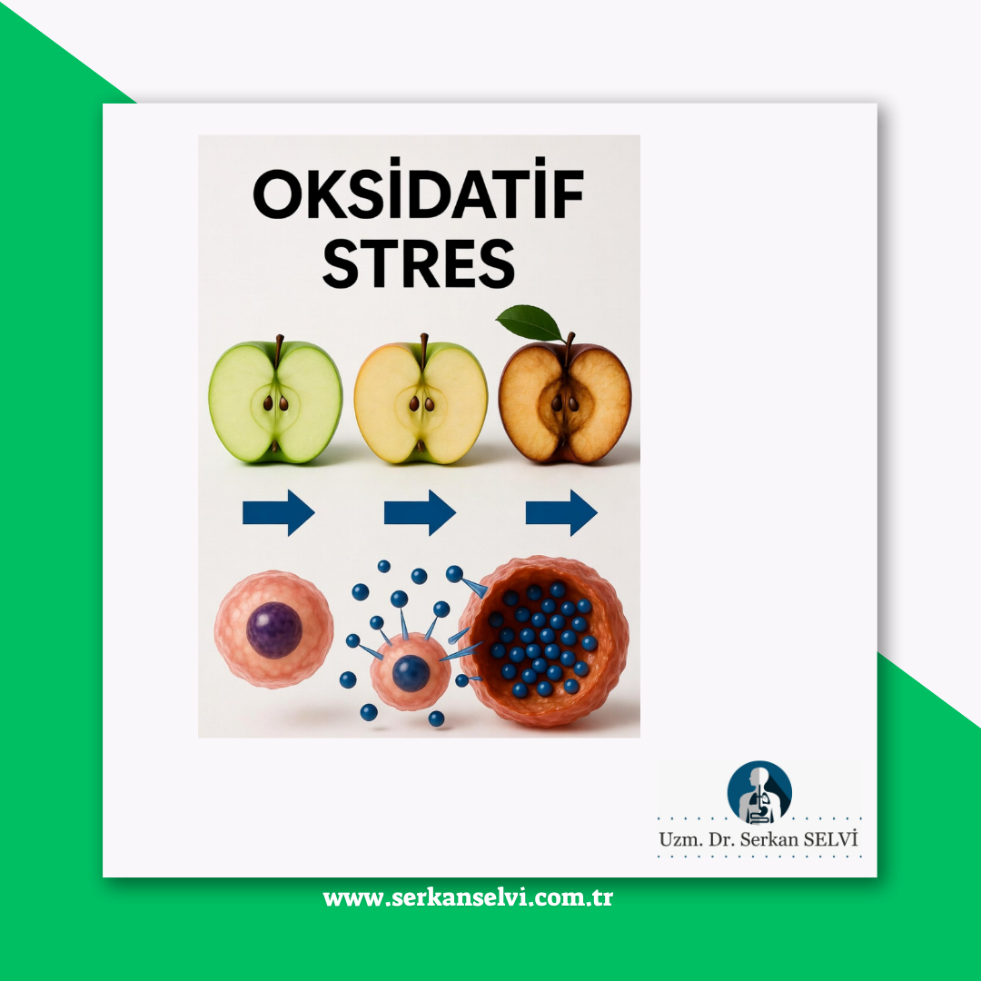 Oksidatif Stres